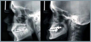 Kraniogram