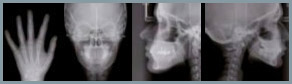 Kraniogram